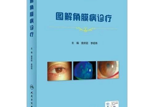 佳作有约丨《图解角膜病诊疗》，浓缩中国角膜病专家宝贵经验的又一力作！