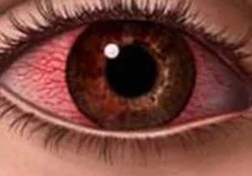 看完大悟！在眼表，角膜神经扮演着什么角色？