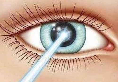 研究揭秘丨为什么视网膜神经节细胞易受青光眼的影响？