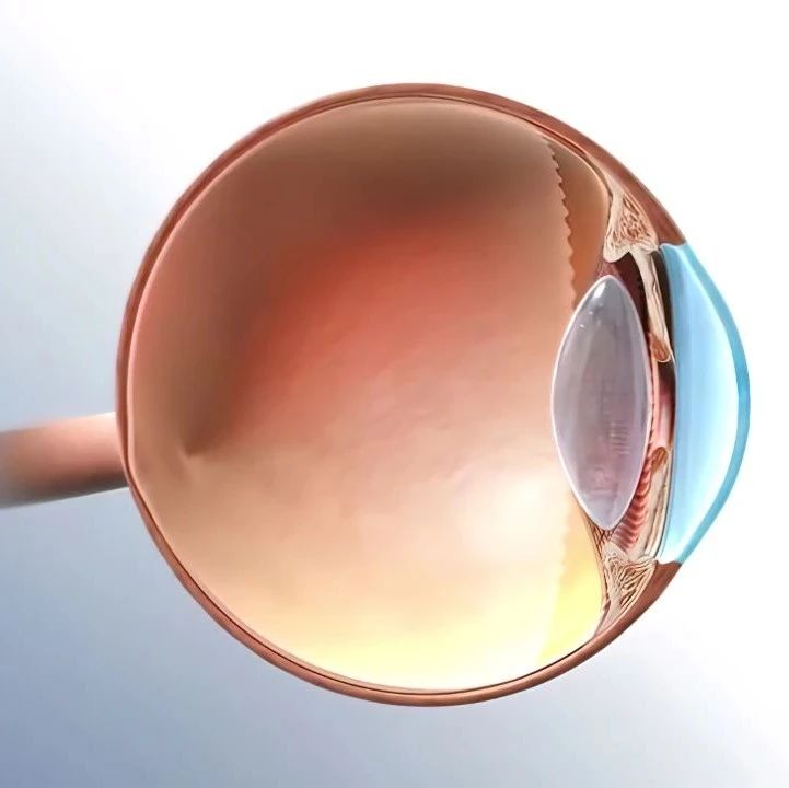 美国眼科学会报告：评估选择性激光小梁成形术治疗青光眼的效果