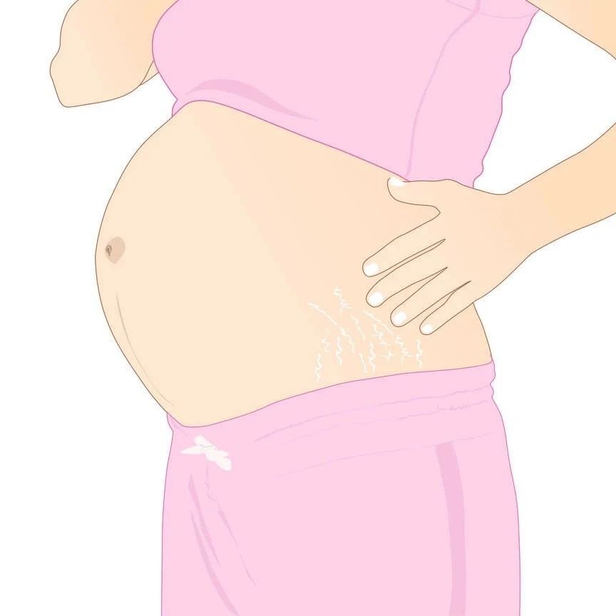 妊娠对点状内层脉络膜病变恶化的影响