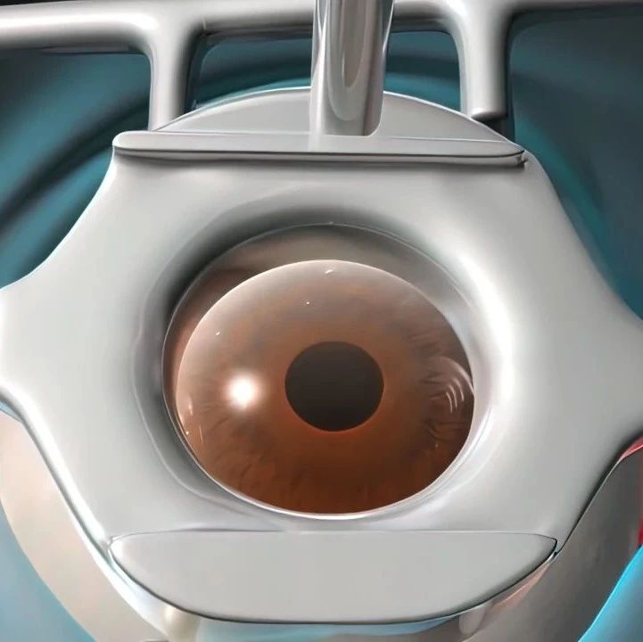 听国际专家揭示白内障手术背后的秘密——论视网膜筛查的重要性