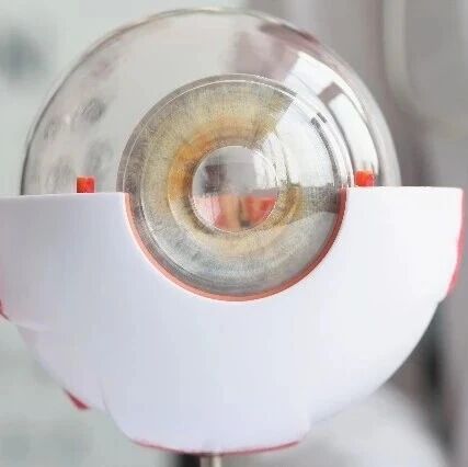 别忽视眼前“黑影”！基层数据显示新发飞蚊症的视网膜脱离风险高于闪光